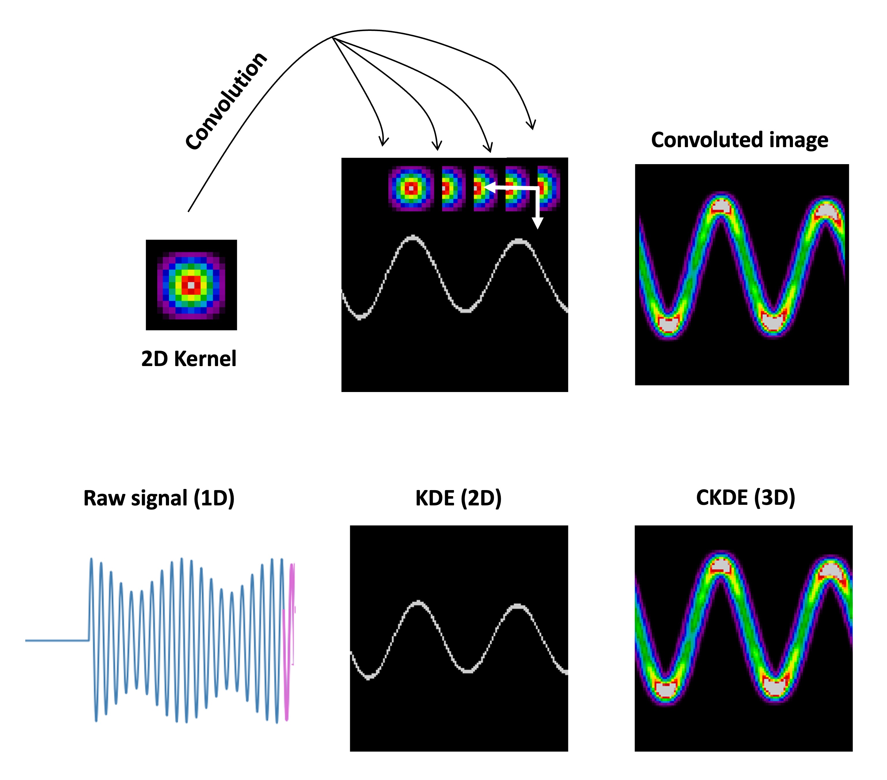 CKDE - Détection automatique de pointes épileptiques