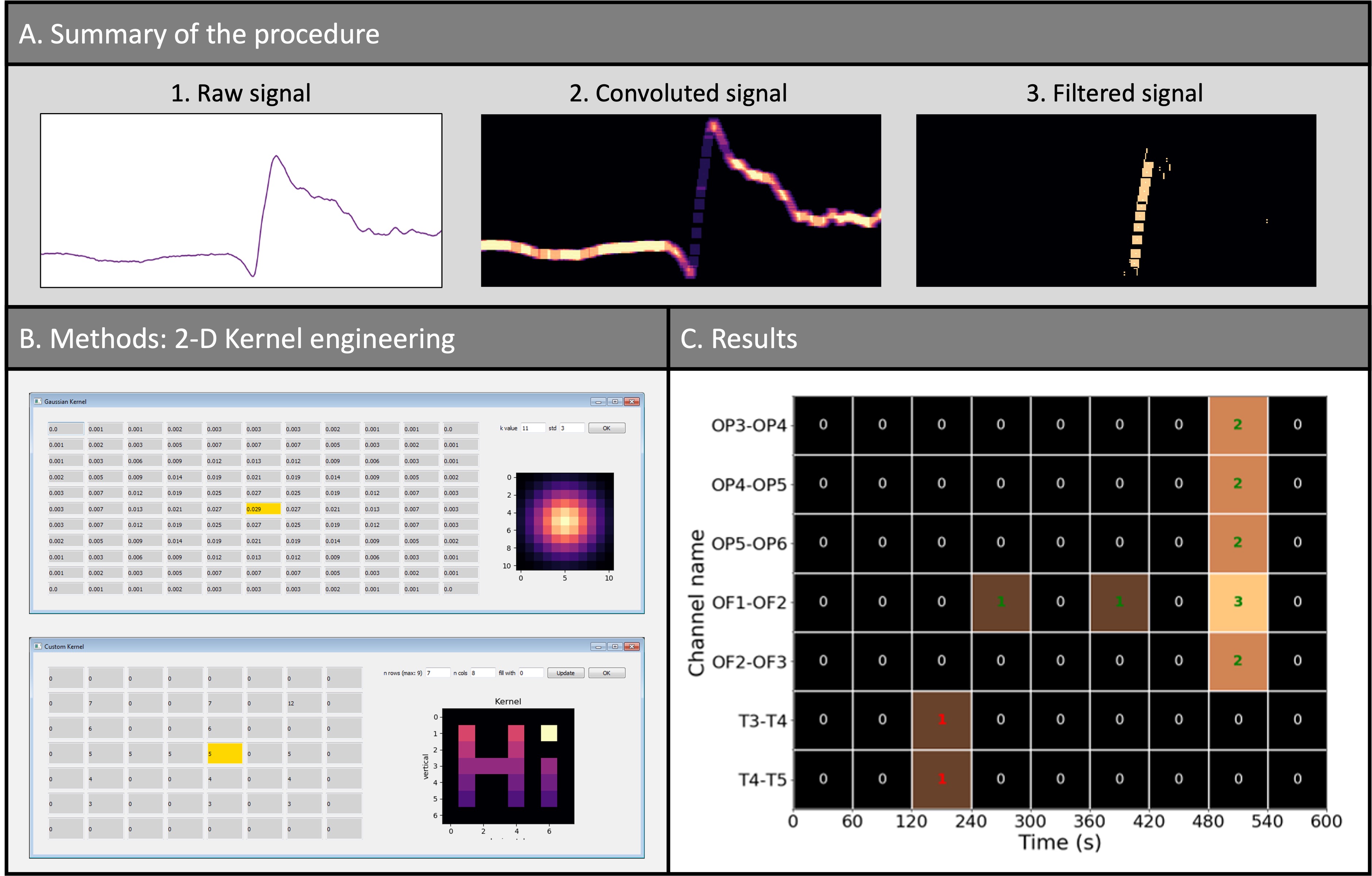 Dashboard CKDE - Interface de détection temps réel