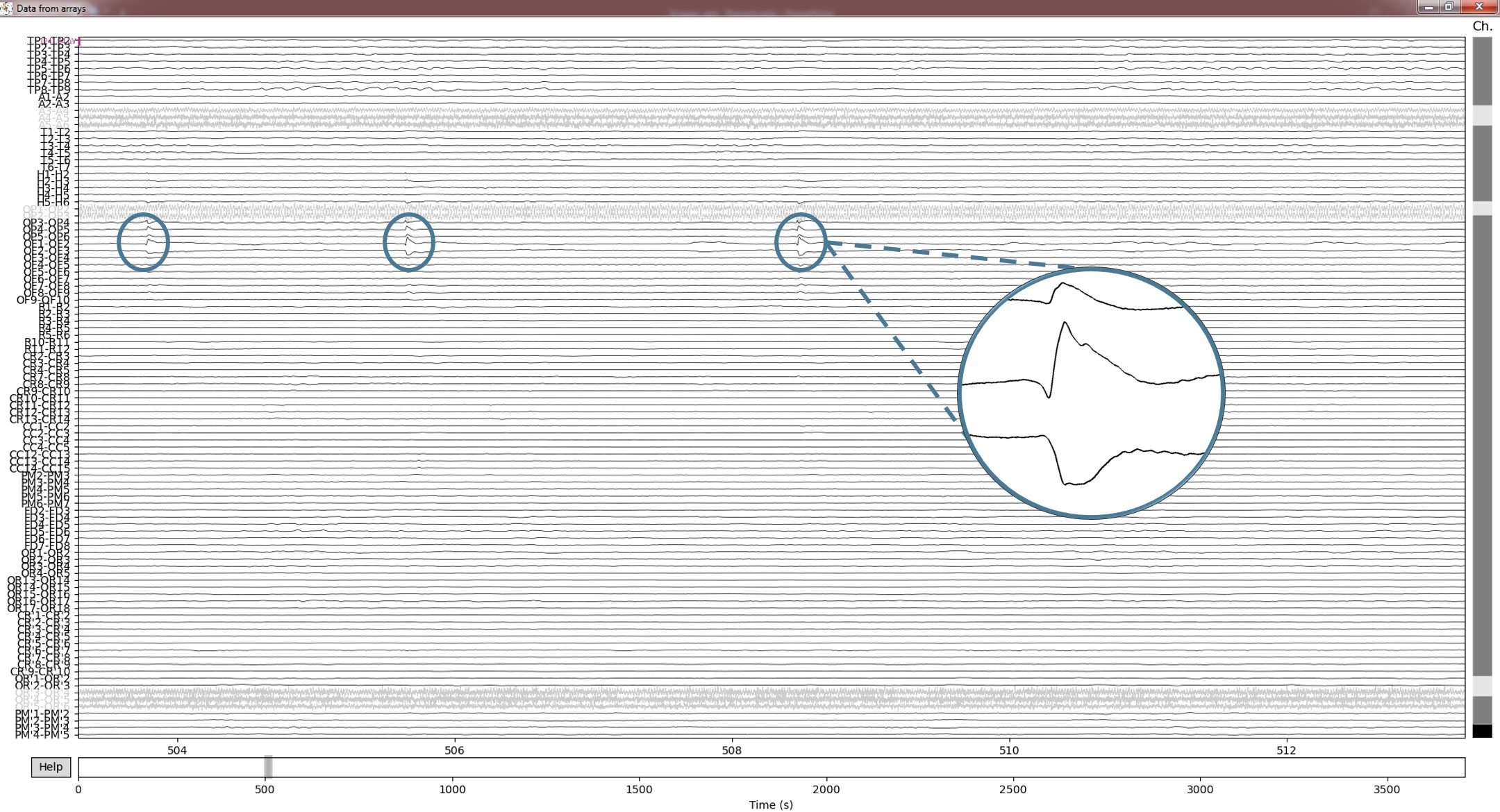 Pipeline EEG - Extraction de fast-ripples (250-500 Hz)