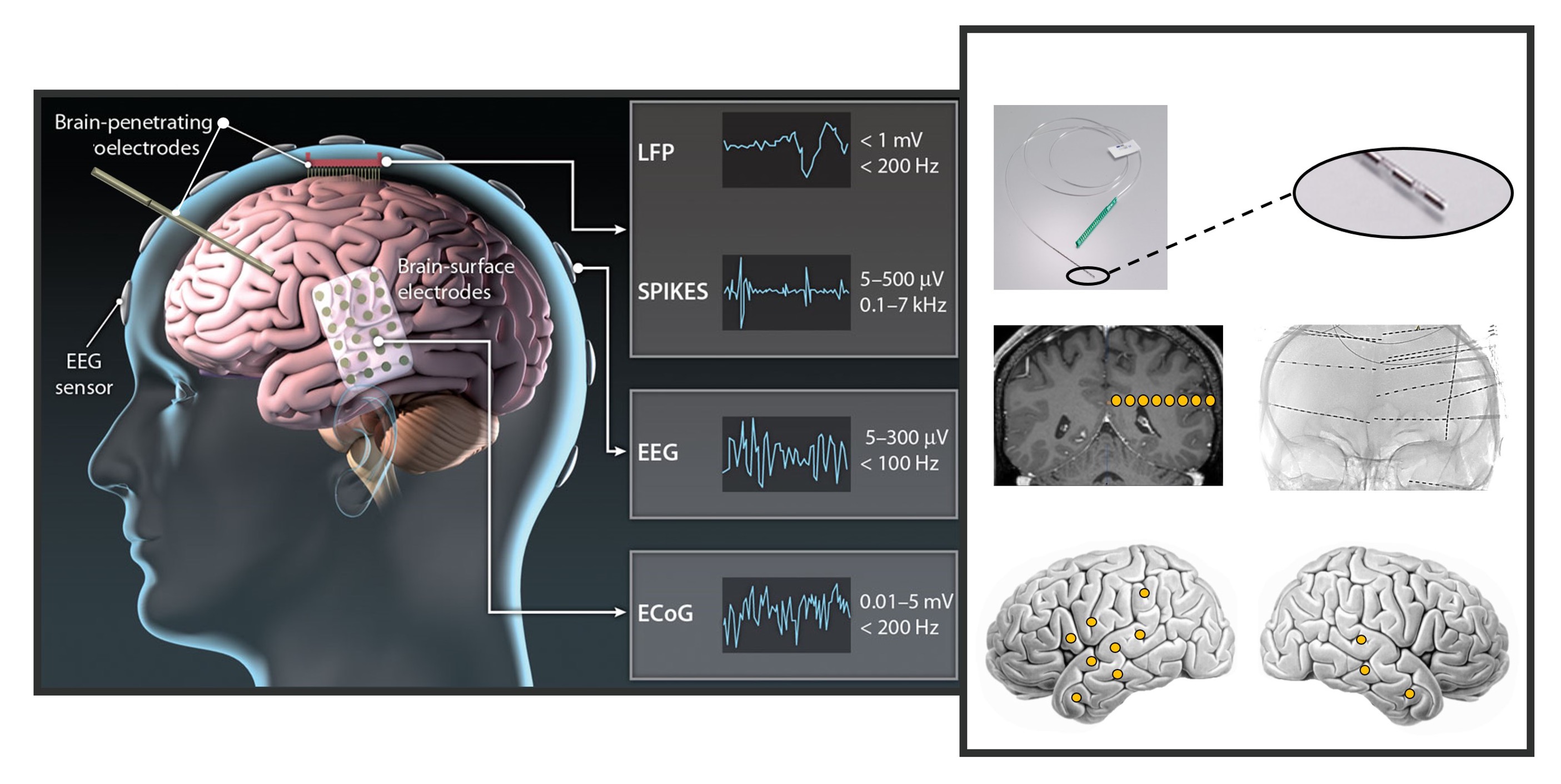 Validation d'électrodes - Benchmark IA sur signaux EEG