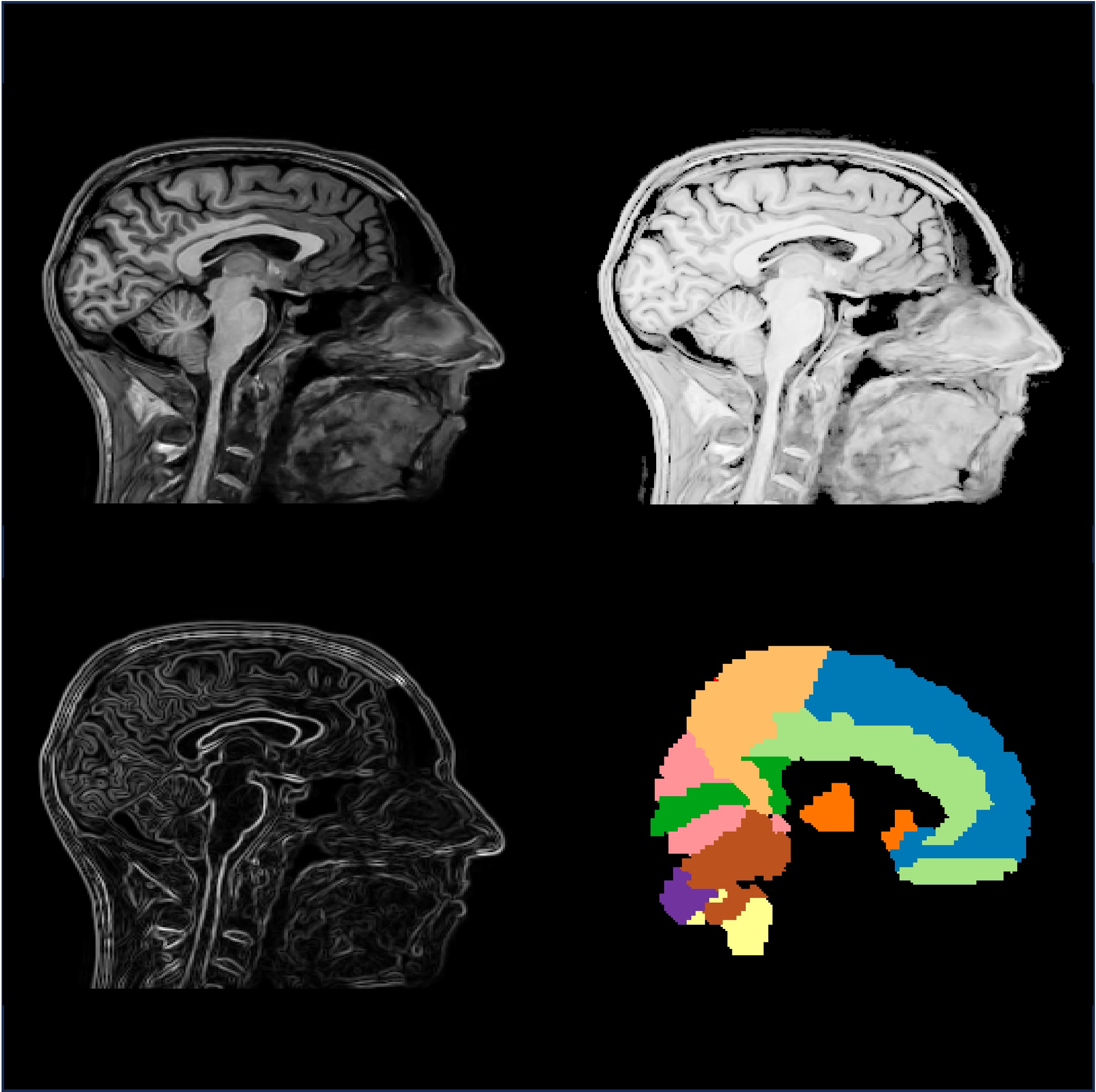 Viewer 3D - Navigation IRM/PET multi-planaire
