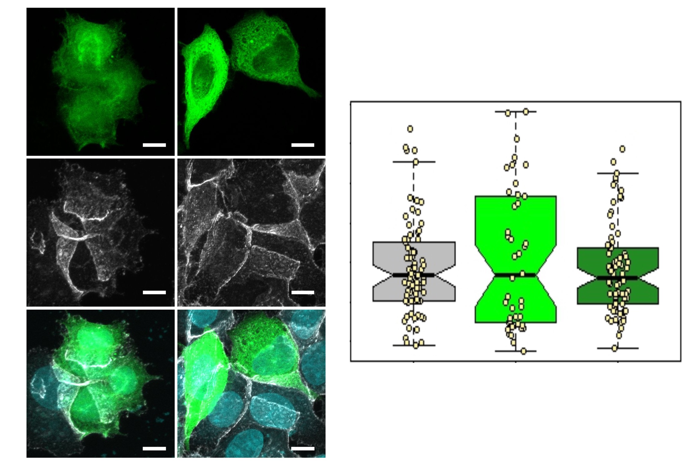 Migration Cellulaire - Analyse du rôle de PI3K dans le cancer