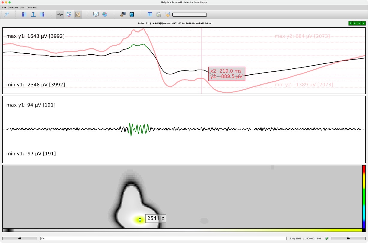 Un événement parmi 2 862 : signal macro, bande filtrée 200-600 Hz et spectrogramme au même instant