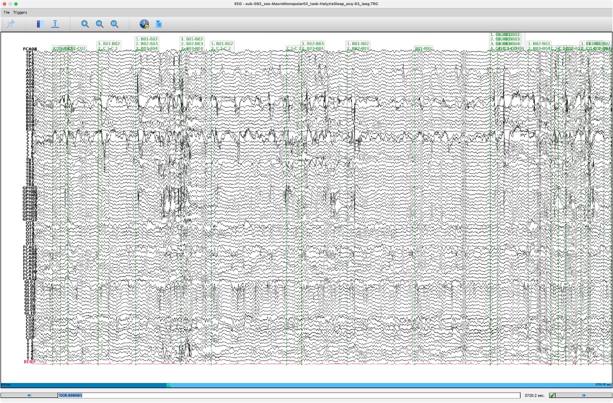 Les détections reportées sur l'enregistrement entier, canal par canal, sur une heure