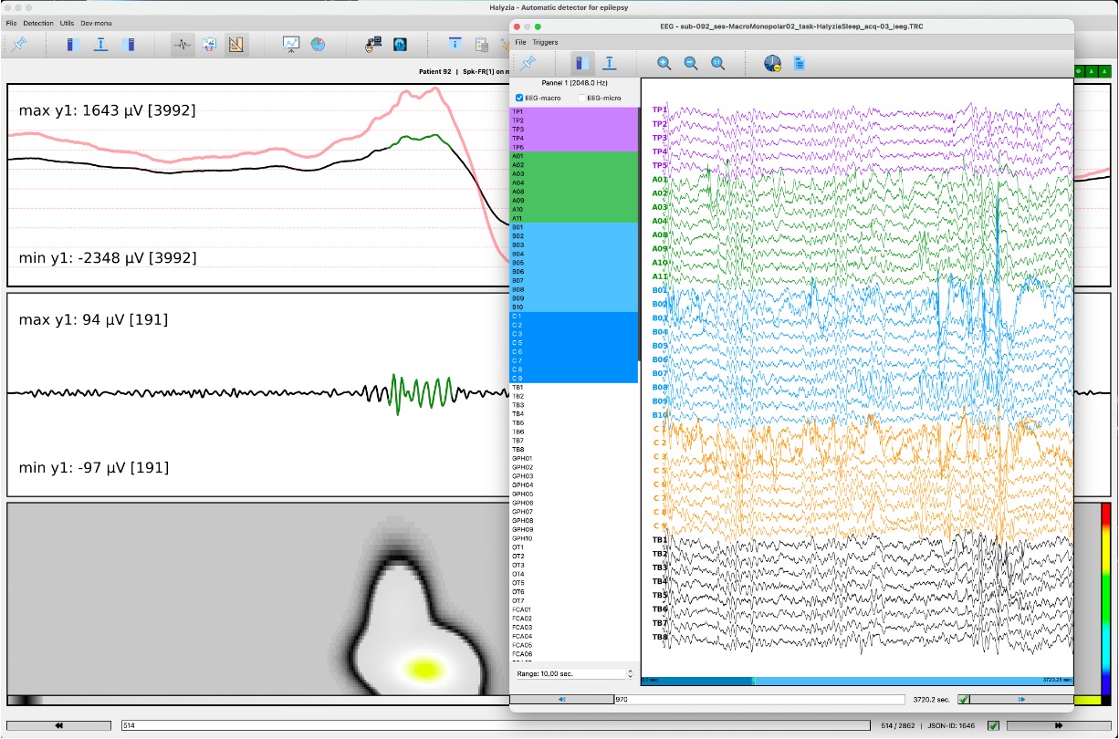 Détection automatique
